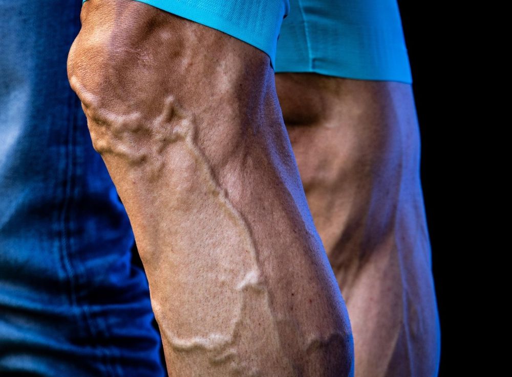 Cyclist s Legs After the Tour de France Why Are They So Veiny